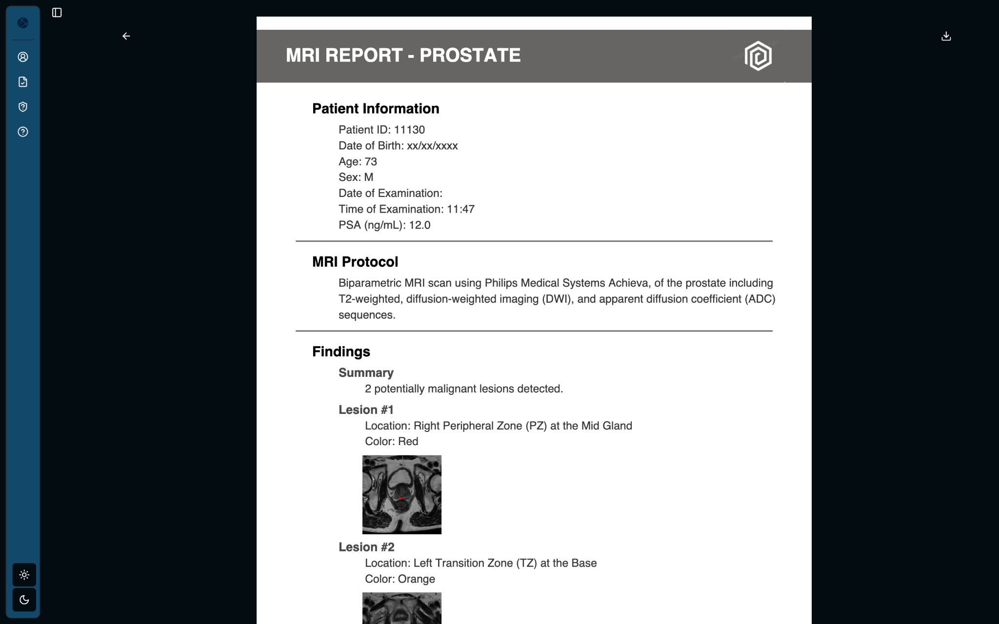 Report
